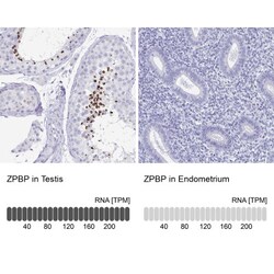 ZPBP Antibody, Novus Biologicals 0.1mL; Unlabeled:Antibodies, Polyclonal